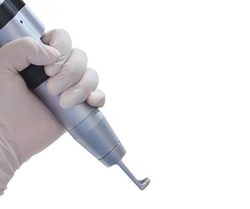 Gloved hand holding medical laser handpiece