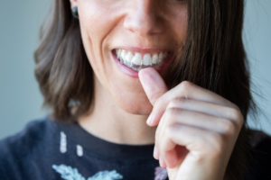 Young woman inserting Invisalign tray to meet her wear time